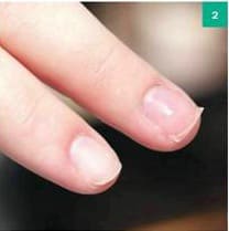 Процедура покрытия ногтей шелком и биогелем