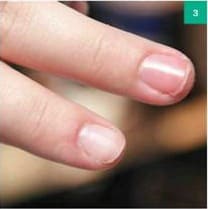 Технология покрытия ногтей шелком и биогелем