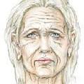 Кожа лица пожилой женщины